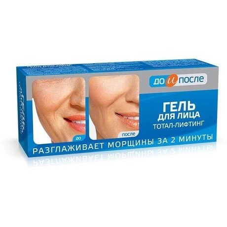 Гель ДО И ПОСЛЕ Тотал-Лифтинг для лица 50мл