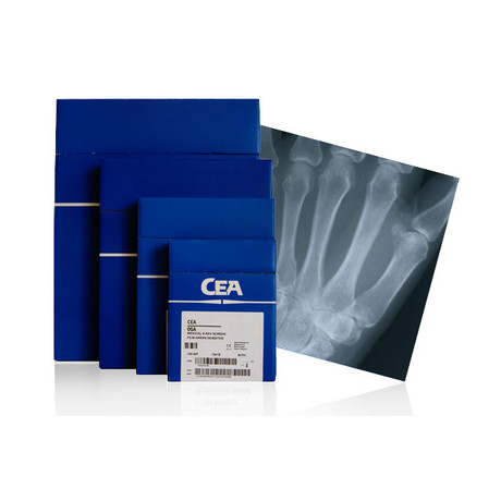 Пленка рентгеновская RETINA XBE 35 х 35см, 100 шт.
